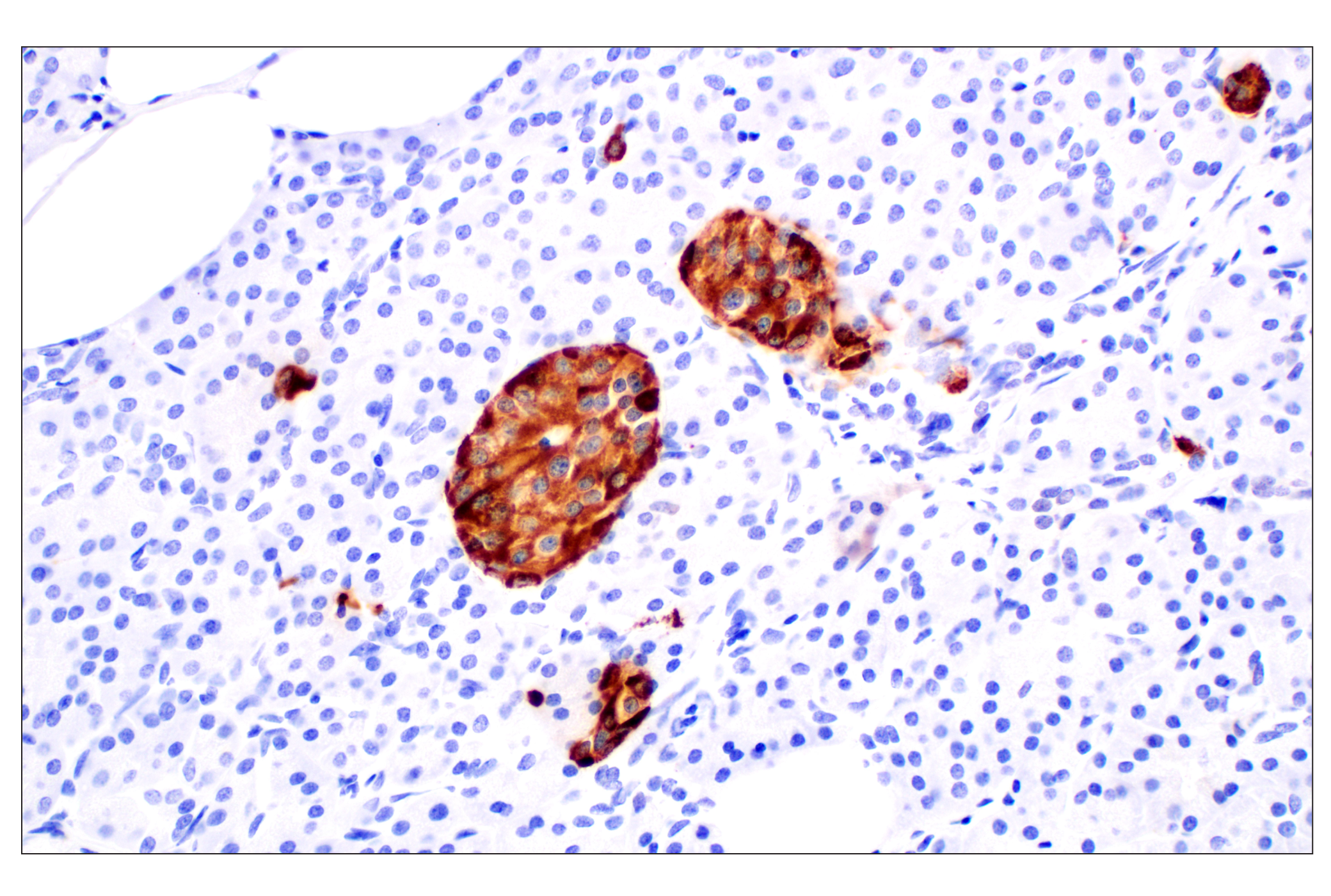 Immunohistochemistry Image 7: CHGA (F7D6H) Rabbit mAb