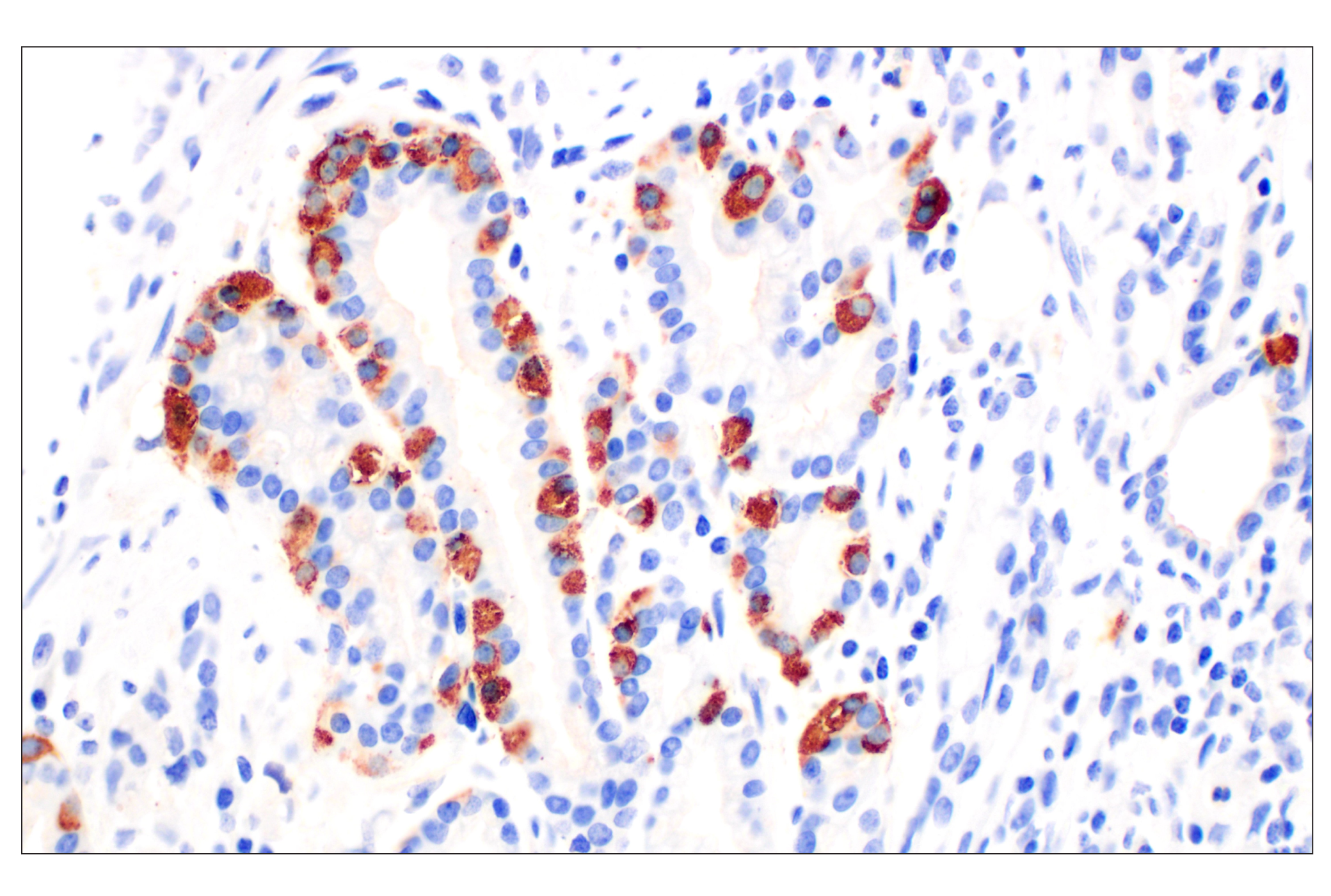 Immunohistochemistry Image 1: CHGA (F7D6H) Rabbit mAb
