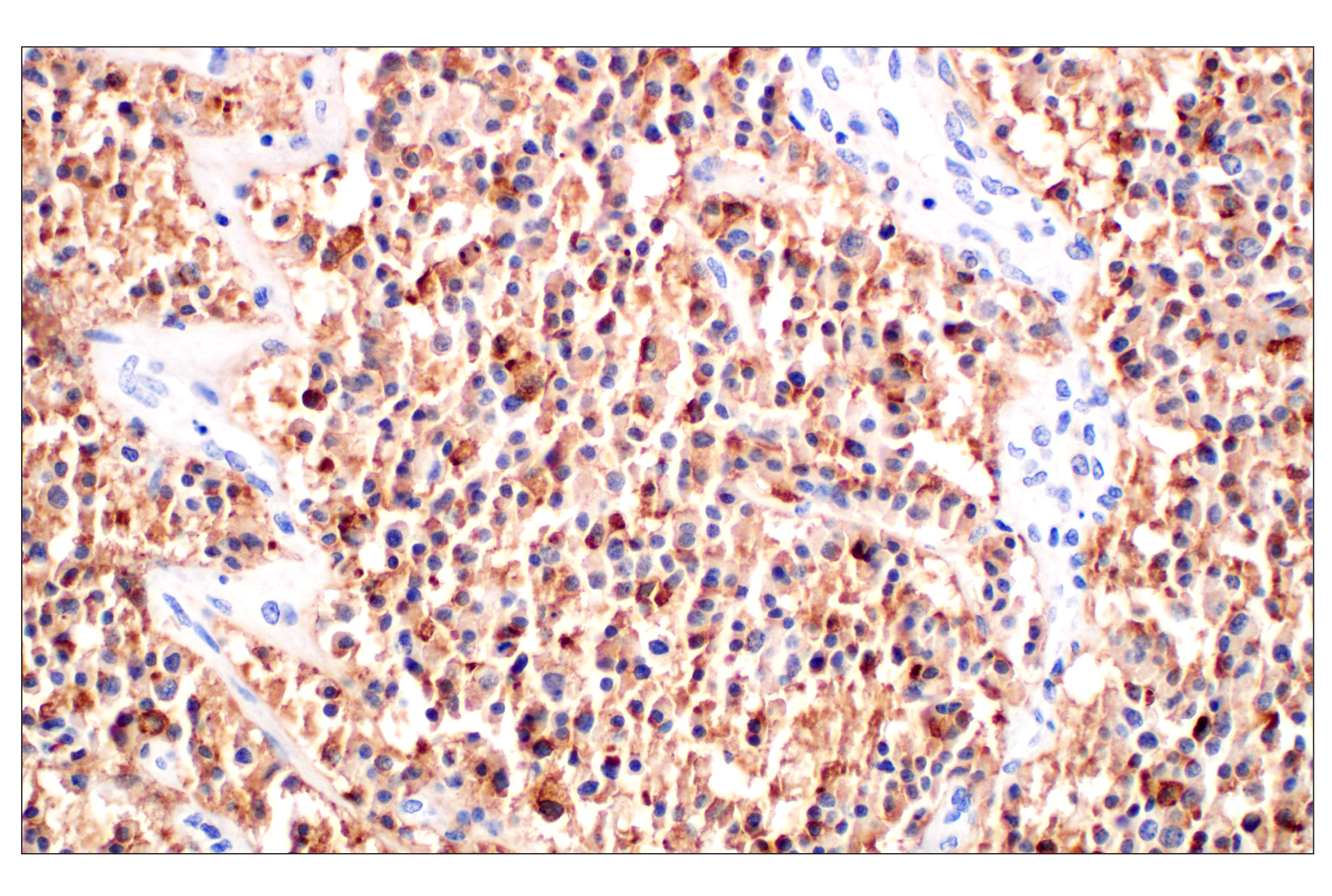 Immunohistochemistry Image 4: CHGA (F7D6H) Rabbit mAb