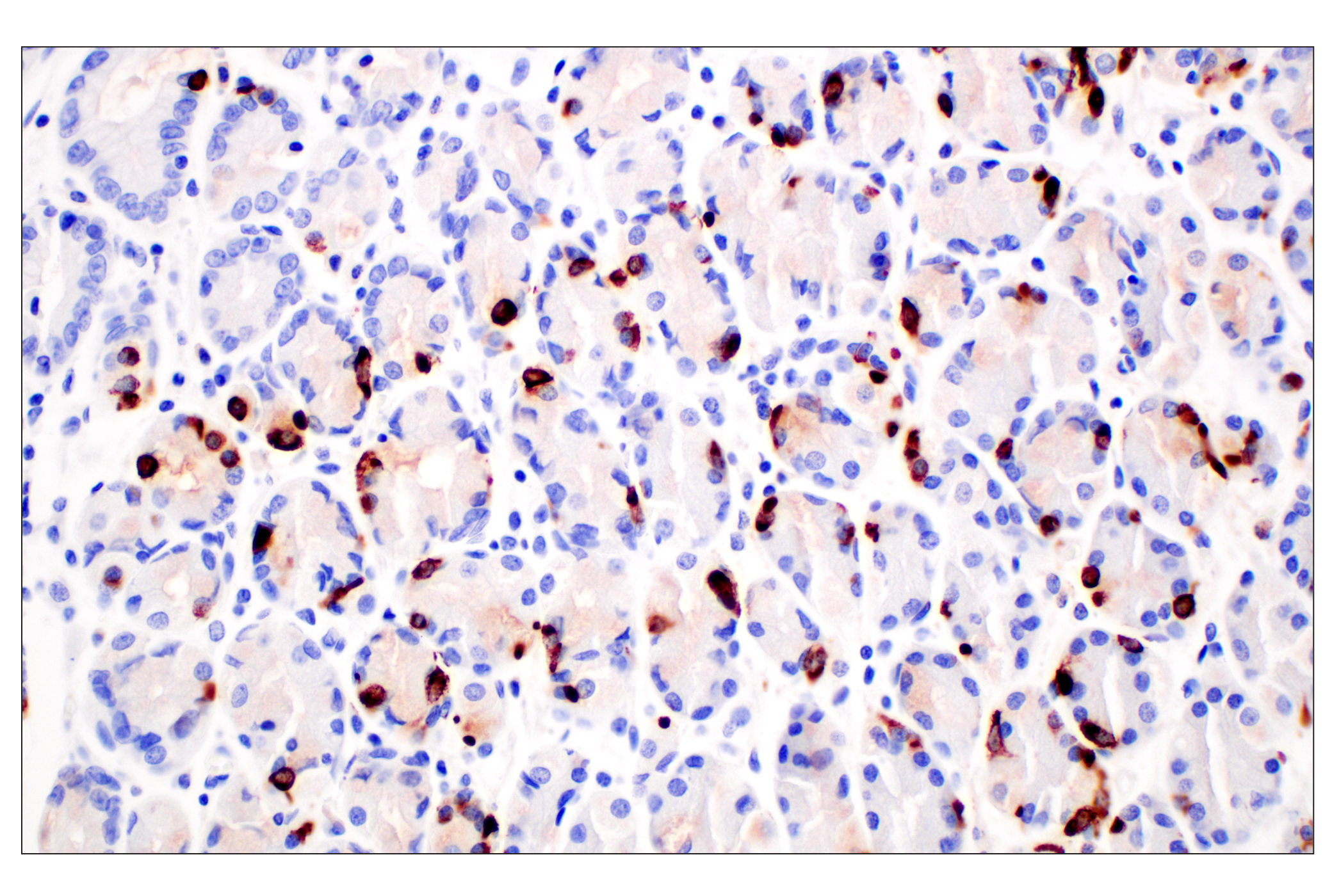 Immunohistochemistry Image 8: CHGA (F7D6H) Rabbit mAb
