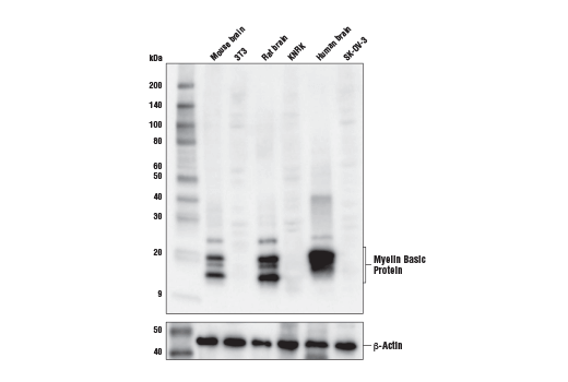 Western Blotting Image 1: Myelin Basic Protein (E9P7U) Mouse mAb