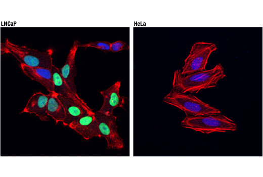 Immunofluorescence Image 1: NKX3.1 (D2Y1A) XP® Rabbit mAb