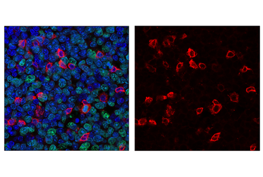 Immunofluorescence Image 1: PD-1 (Intracellular Domain) (D7D5W) XP® Rabbit mAb (Alexa Fluor® 594 Conjugate)