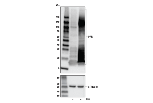 Western Blotting Image 2: Poly/Mono-ADP Ribose (E6F6A) Rabbit mAb