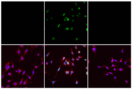 Immunofluorescence Image 1: Poly/Mono-ADP Ribose (E6F6A) Rabbit mAb