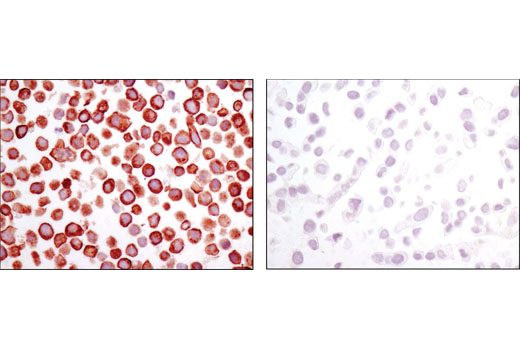 Immunohistochemistry Image 5: Met (D1C2) XP® Rabbit mAb (BSA and Azide Free)