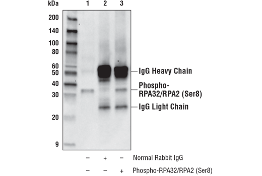 Immunoprecipitation Image 1: Phospho-RPA32/RPA2 (Ser8) Antibody