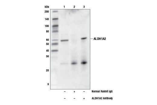 Immunoprecipitation Image 1: ALDH1A2 Antibody