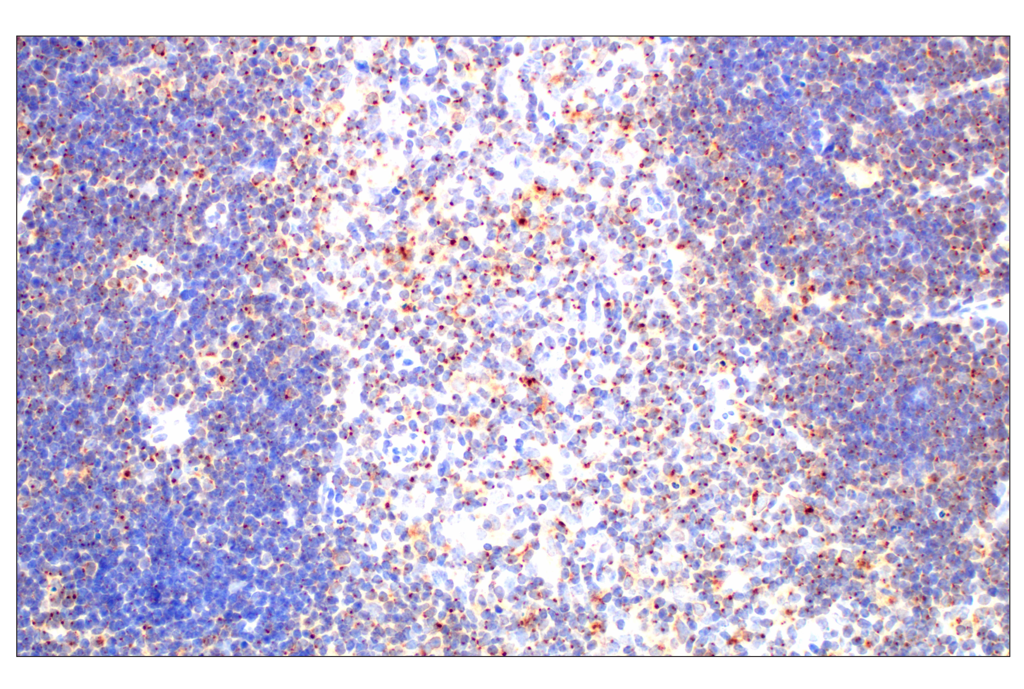 Immunohistochemistry Image 4: LAPTM5 (E7D5O) Rabbit mAb