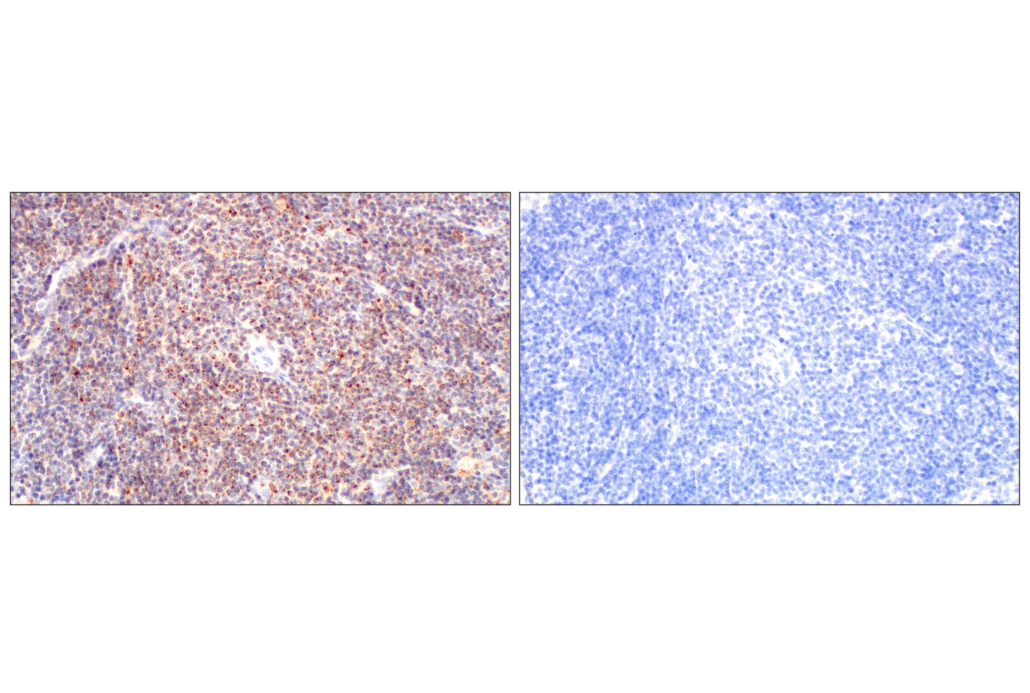 Immunohistochemistry Image 5: LAPTM5 (E7D5O) Rabbit mAb