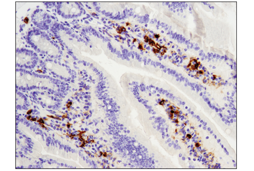 Immunohistochemistry Image 1: TIM-3 (D3M9R) XP® Rabbit mAb (Mouse Specific)