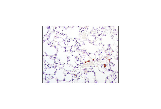 Immunohistochemistry Image 2: TIM-3 (D3M9R) XP® Rabbit mAb (Mouse Specific)