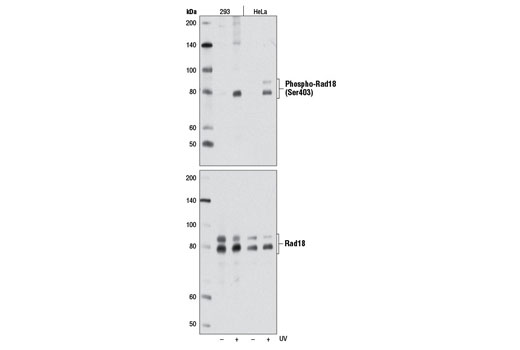 Western Blotting Image 1: Phospho-Rad18 (Ser403) Antibody