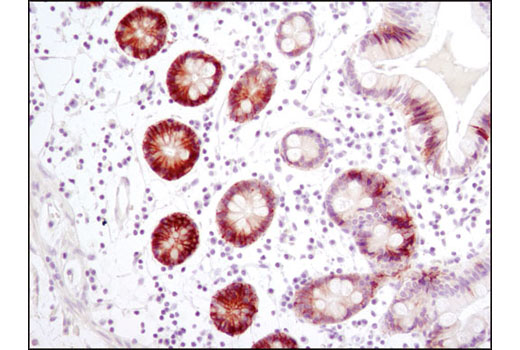 Immunohistochemistry Image 1: CA9 (D10C10) Rabbit mAb (BSA and Azide Free)