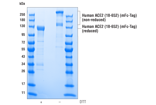  Image 3: Human ACE2 (18-652) Recombinant Protein (mFc-Tag)