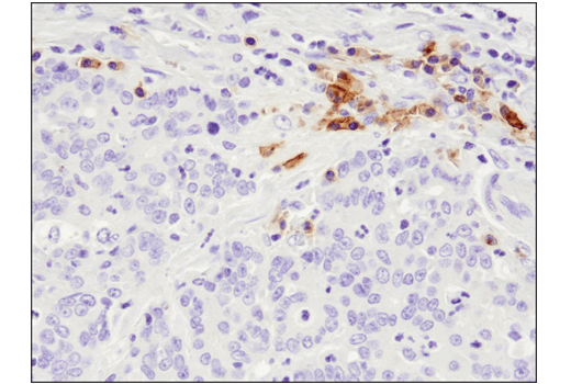 Immunohistochemistry Image 4: TNFRSF17/BCMA (E6D7B) Rabbit mAb (BSA and Azide Free)