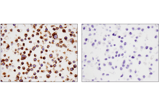 Immunohistochemistry Image 7: TNFRSF17/BCMA (E6D7B) Rabbit mAb (BSA and Azide Free)