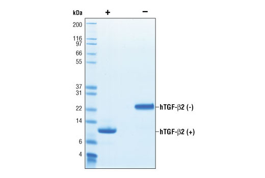  Image 2: Human Transforming Growth Factor β2 (hTGF-β2)