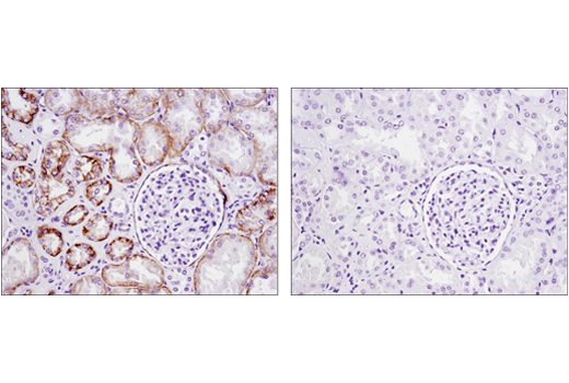 Immunohistochemistry Image 3: Cadherin-6 (D3T3I) Rabbit mAb (BSA and Azide Free)