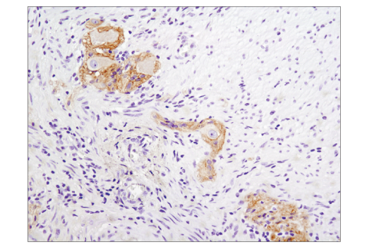 Immunohistochemistry Image 5: N-Cadherin (D4R1H) XP® Rabbit mAb (BSA and Azide Free)