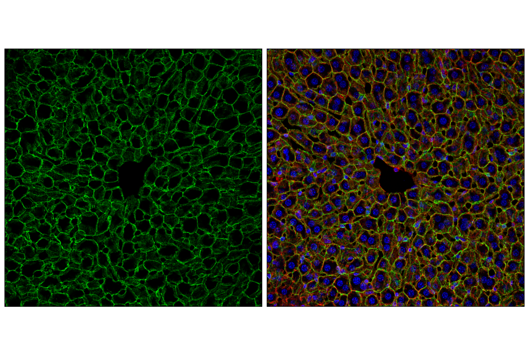 Immunofluorescence Image 1: N-Cadherin (D4R1H) Rabbit Monoclonal Antibody (BSA and Azide Free)
