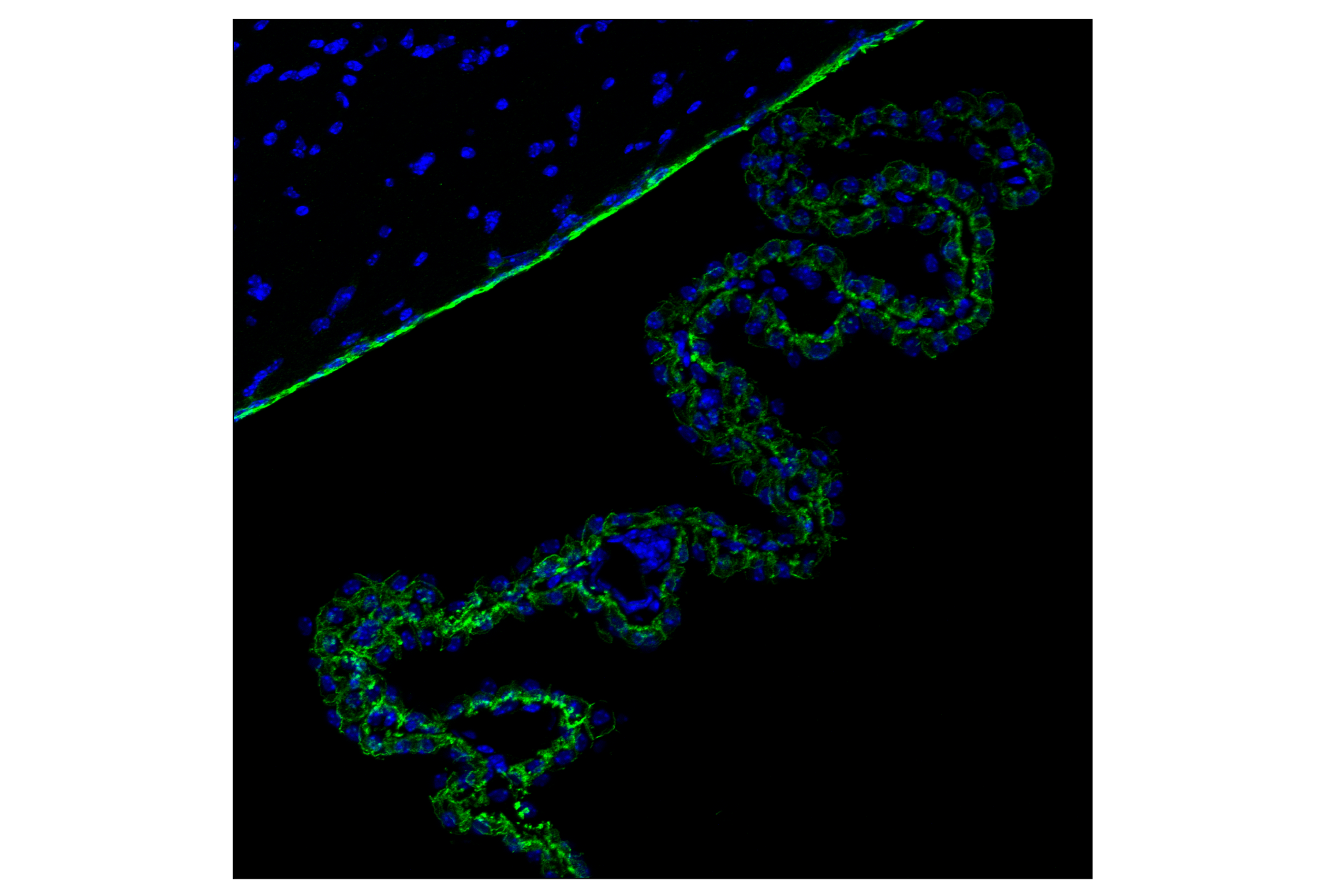 Immunofluorescence Image 2: N-Cadherin (D4R1H) Rabbit Monoclonal Antibody (BSA and Azide Free)