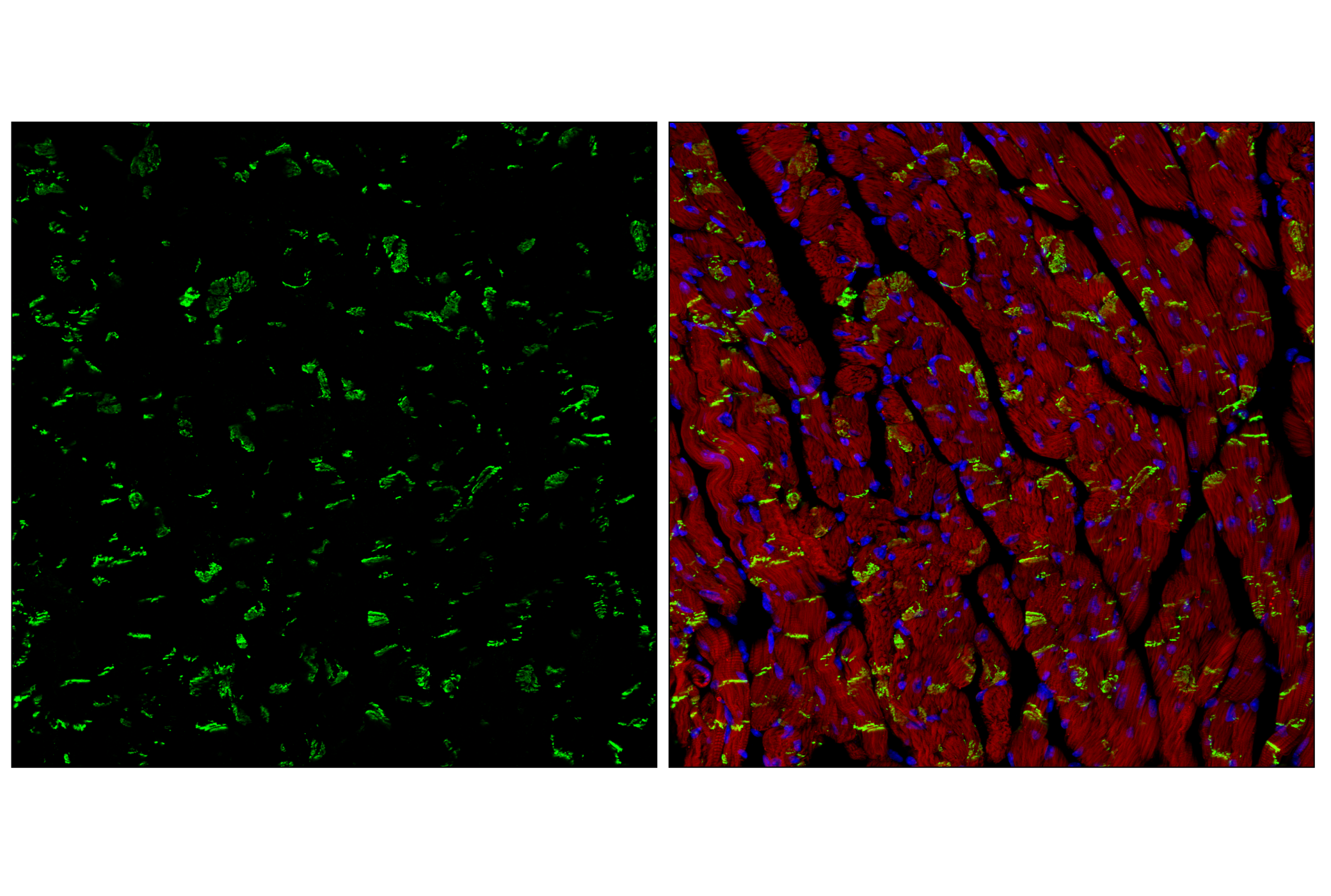 Immunofluorescence Image 3: N-Cadherin (D4R1H) Rabbit Monoclonal Antibody (BSA and Azide Free)