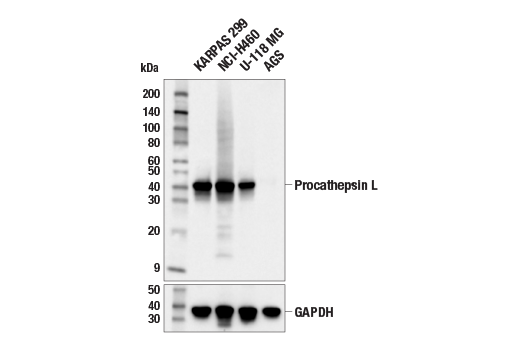 Western Blotting Image 1: Procathepsin L (E9B2U) Rabbit mAb