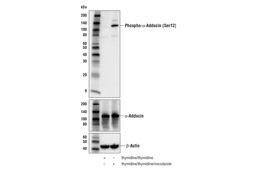 Western Blotting Image 1: Phospho-α-Adducin (Ser12) (E5X8Y) Rabbit mAb