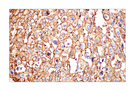 Immunohistochemistry Image 1: Glut1 (E4S6I) Rabbit mAb (BSA and Azide Free)