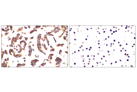 Immunohistochemistry Image 2: Glut1 (E4S6I) Rabbit mAb (BSA and Azide Free)