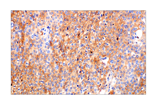 Immunohistochemistry Image 4: Glut1 (E4S6I) Rabbit mAb (BSA and Azide Free)
