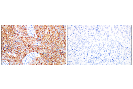 Immunohistochemistry Image 8: Glut1 (E4S6I) Rabbit mAb (BSA and Azide Free)