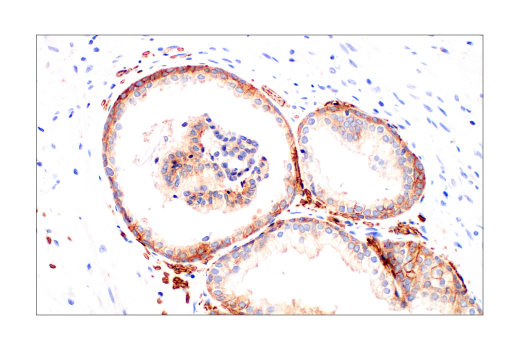 Immunohistochemistry Image 9: Glut1 (E4S6I) Rabbit mAb (BSA and Azide Free)