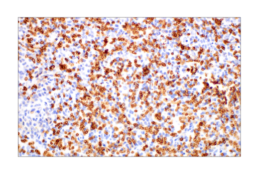 Immunohistochemistry Image 10: Glut1 (E4S6I) Rabbit mAb (BSA and Azide Free)