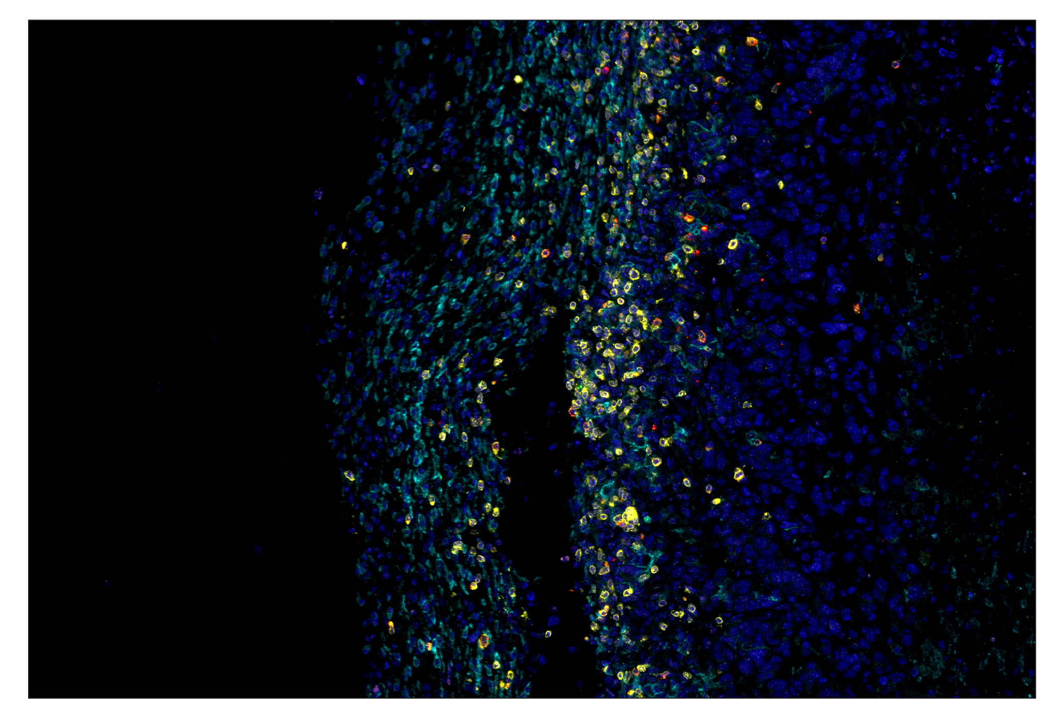Immunohistochemistry Image 7: Granzyme B (E5V2L) & CO-0049-750 SignalStar™ Oligo-Antibody Pair
