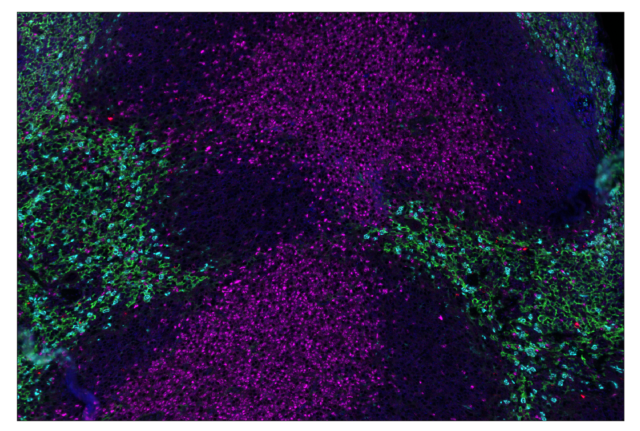 Immunohistochemistry Image 8: Granzyme B (E5V2L) & CO-0049-488 SignalStar™ Oligo-Antibody Pair