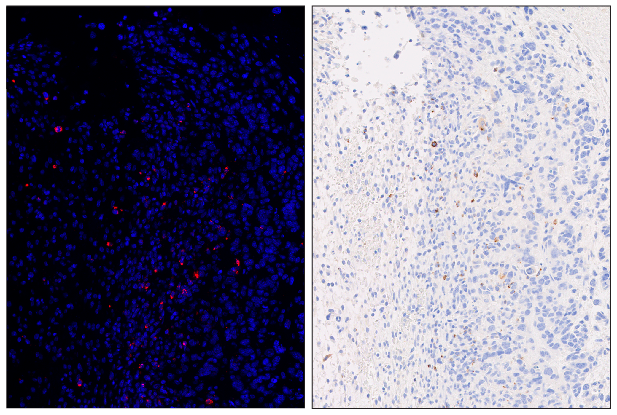 Immunohistochemistry Image 6: Granzyme B (E5V2L) & CO-0049-594 SignalStar™ Oligo-Antibody Pair