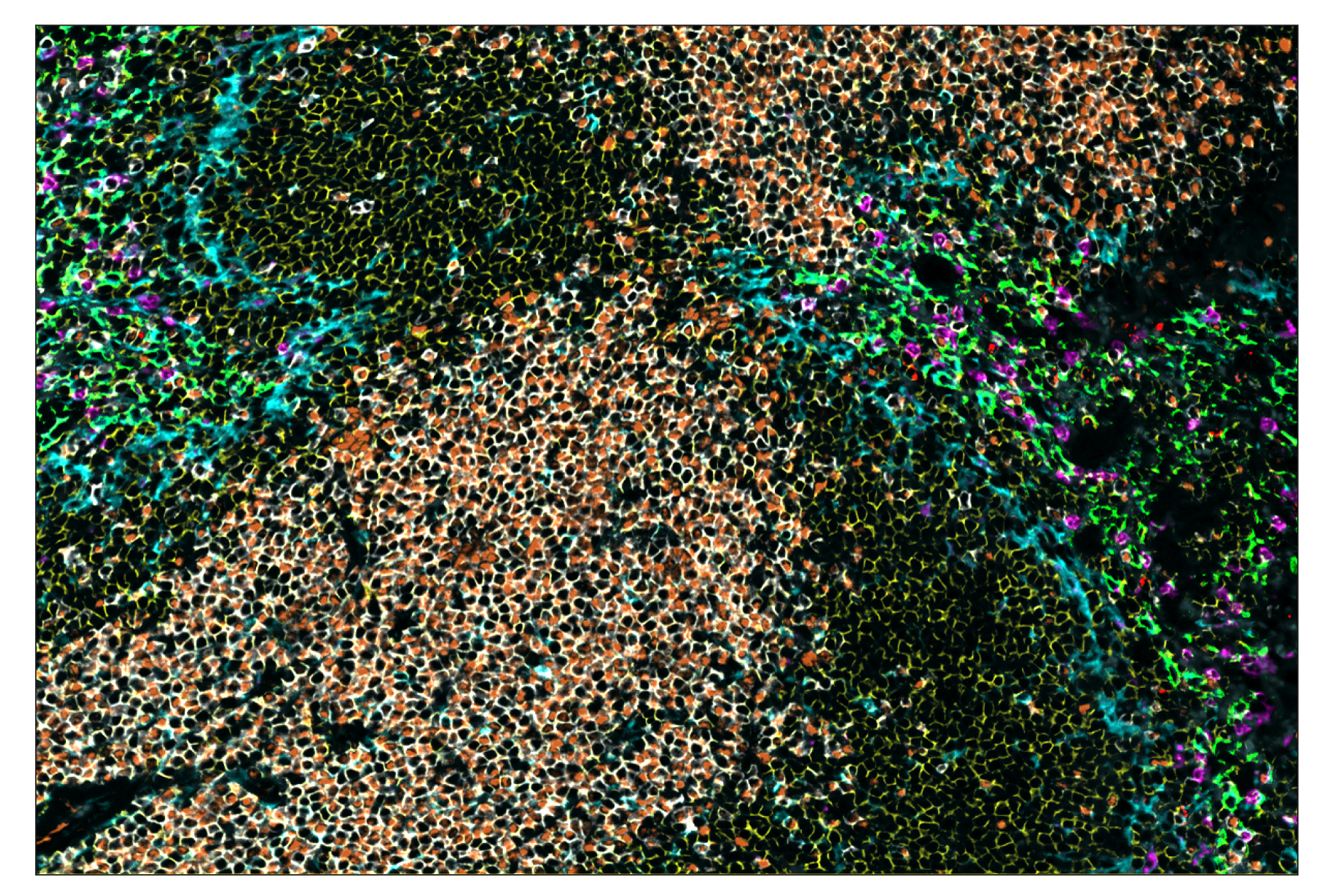 Immunohistochemistry Image 1: Granzyme B (E5V2L) & CO-0049-594 SignalStar™ Oligo-Antibody Pair