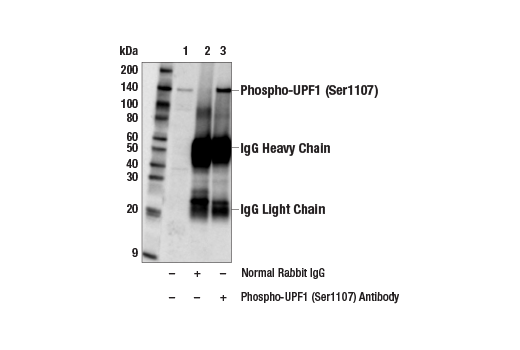Immunoprecipitation Image 1: Phospho-UPF1 (Ser1107) Antibody