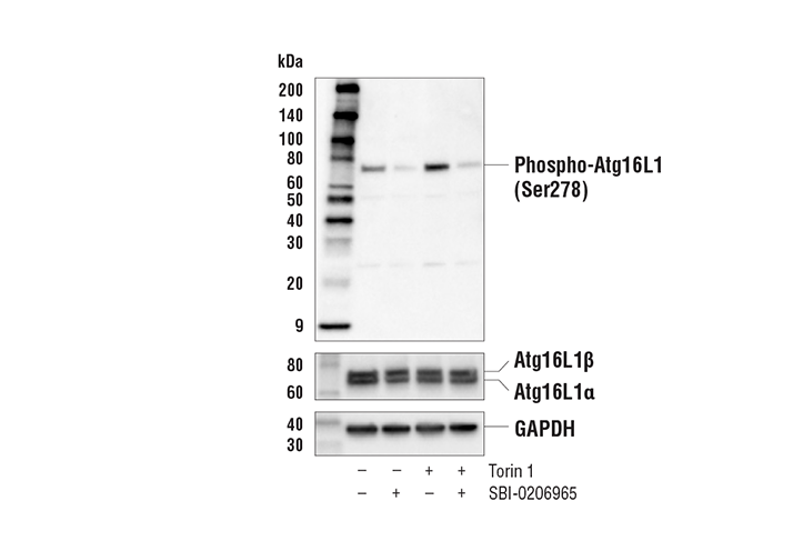 Western Blotting Image 2: Phospho-Atg16L1 (Ser278) Antibody
