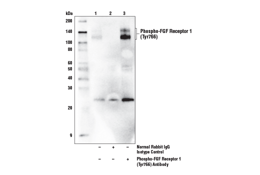 Immunoprecipitation Image 1: Phospho-FGF Receptor 1 (Tyr766) Antibody