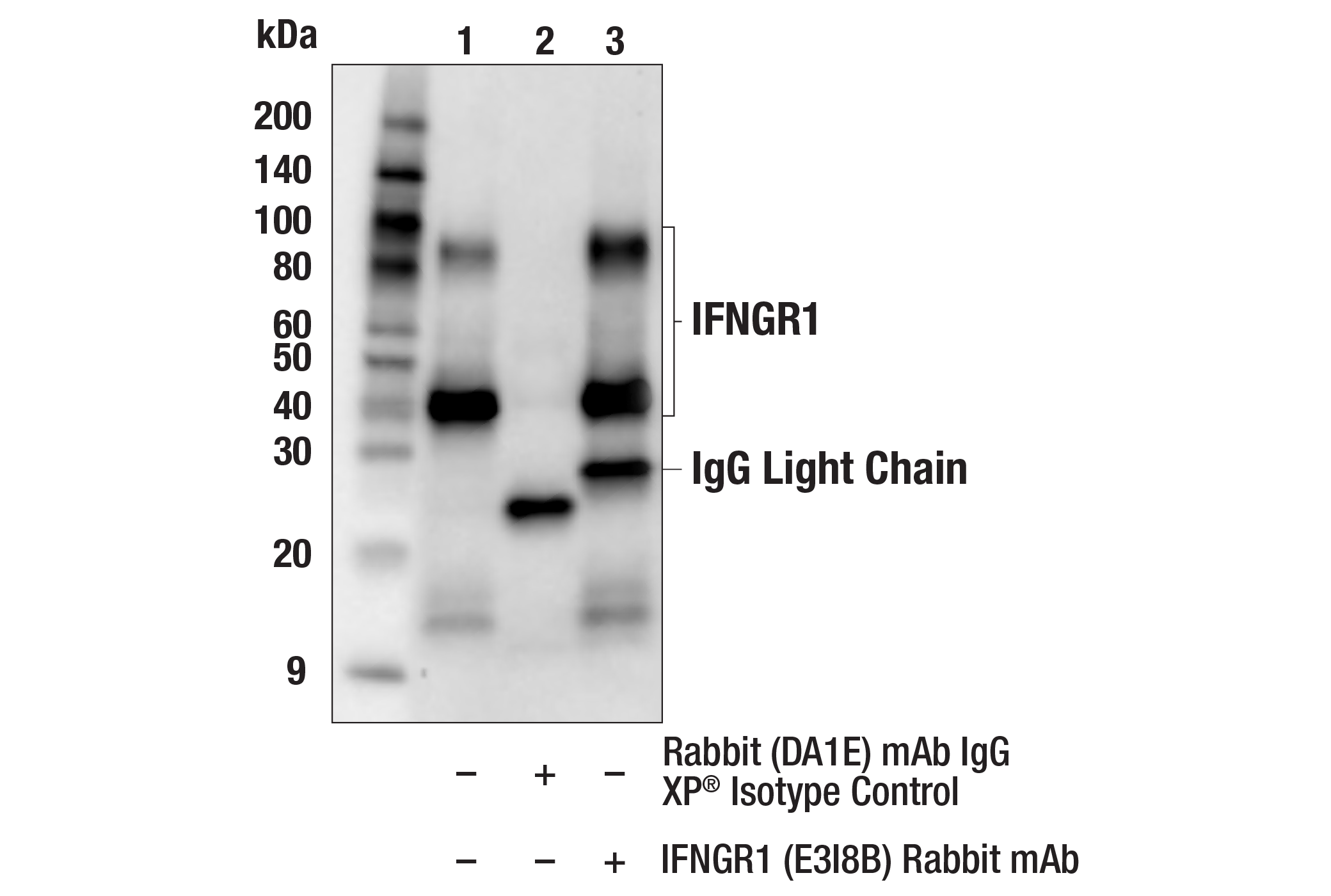 Immunoprecipitation Image 1: IFNGR1 (E3I8B) Rabbit mAb