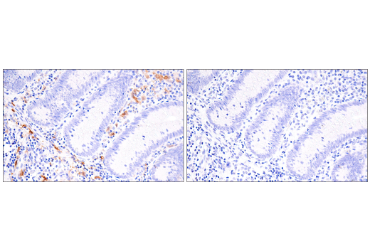 Immunohistochemistry Image 7: Factor XIIIA (E980.1) Mouse mAb