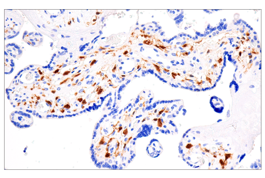 Immunohistochemistry Image 4: Factor XIIIA (E980.1) Mouse mAb