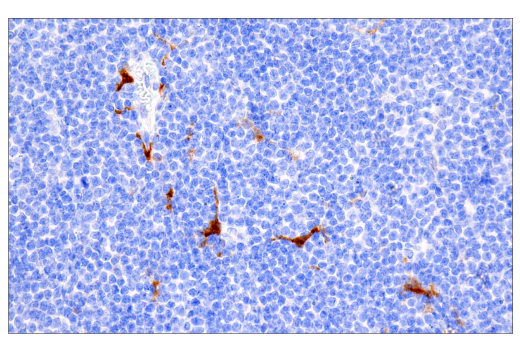 Immunohistochemistry Image 2: Factor XIIIA (E980.1) Mouse mAb