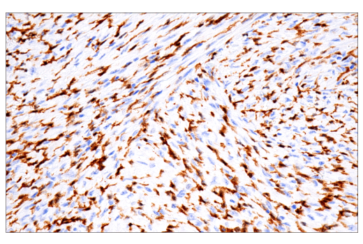 Immunohistochemistry Image 1: Factor XIIIA (E980.1) Mouse mAb