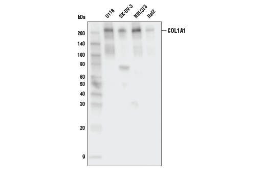 Western Blotting Image 1: COL1A1 Antibody