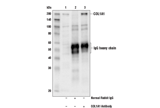 Immunoprecipitation Image 1: COL1A1 Antibody