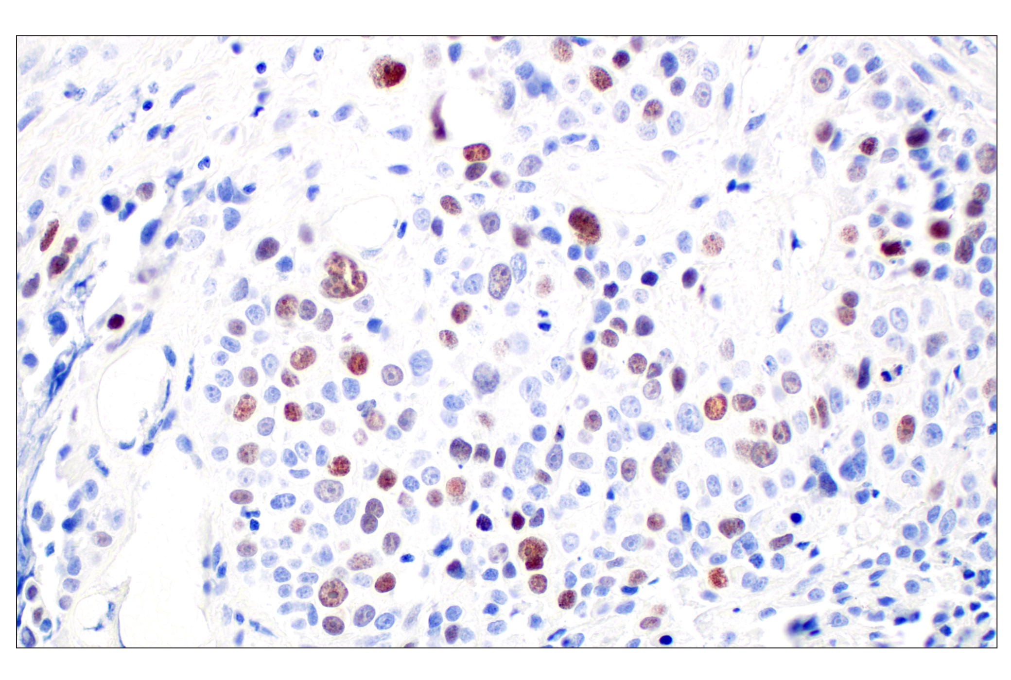 Immunohistochemistry Image 5: SGO2 (E9K4N) Rabbit mAb (BSA and Azide Free)